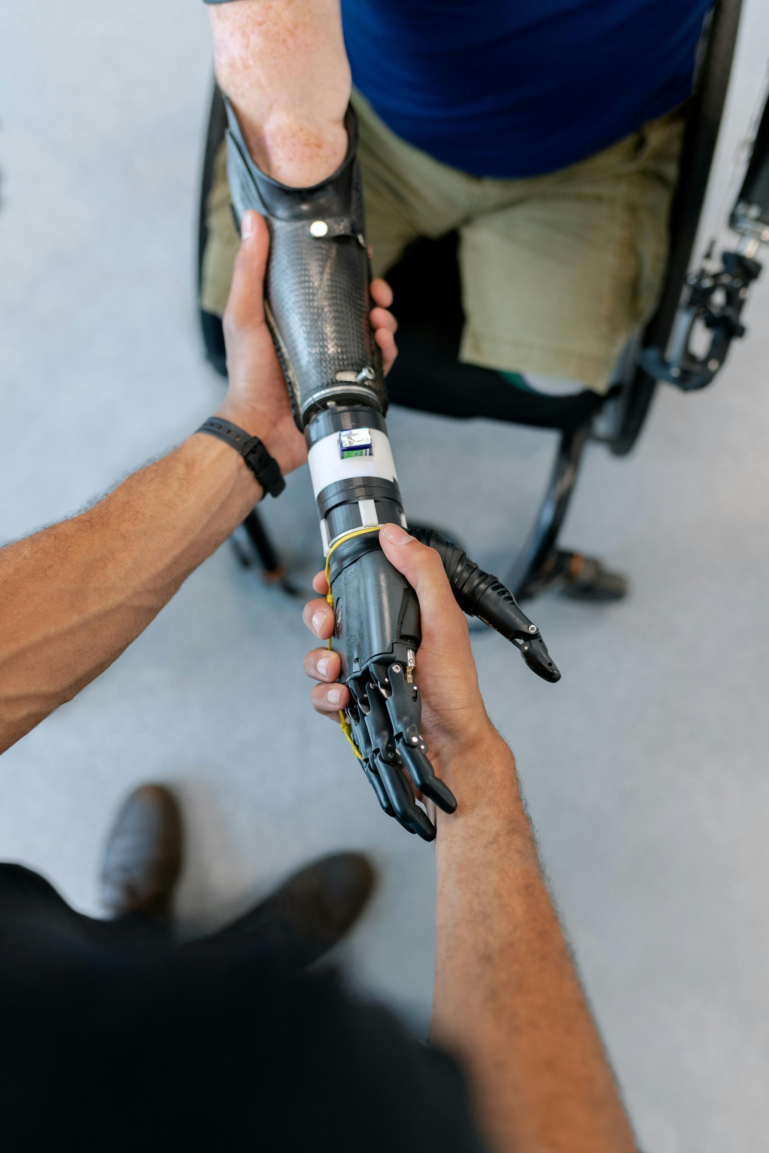 Two men holding hands, one with prosthesis